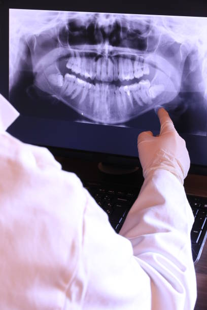 Best Emergency Denture Repair in Mitchell, IN